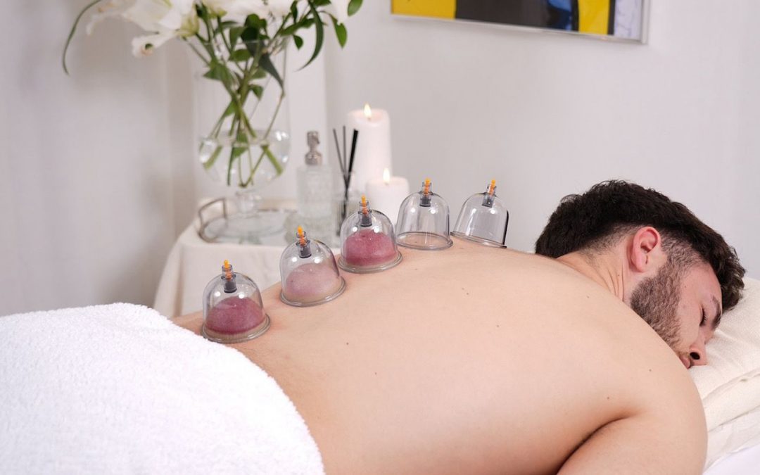 Terapia con Ventosas en Sol, Madrid